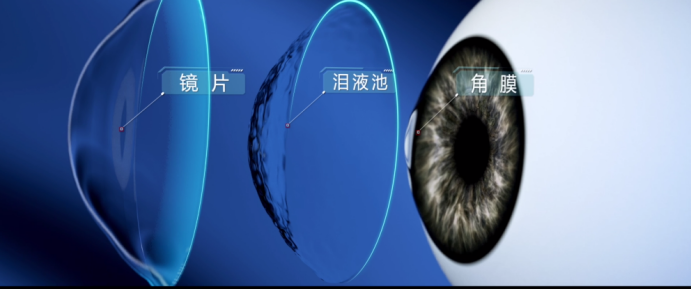 
			林江院长赴长沙见证爱尔眼科巩膜镜技术诊疗门诊启动仪式
		(图2)